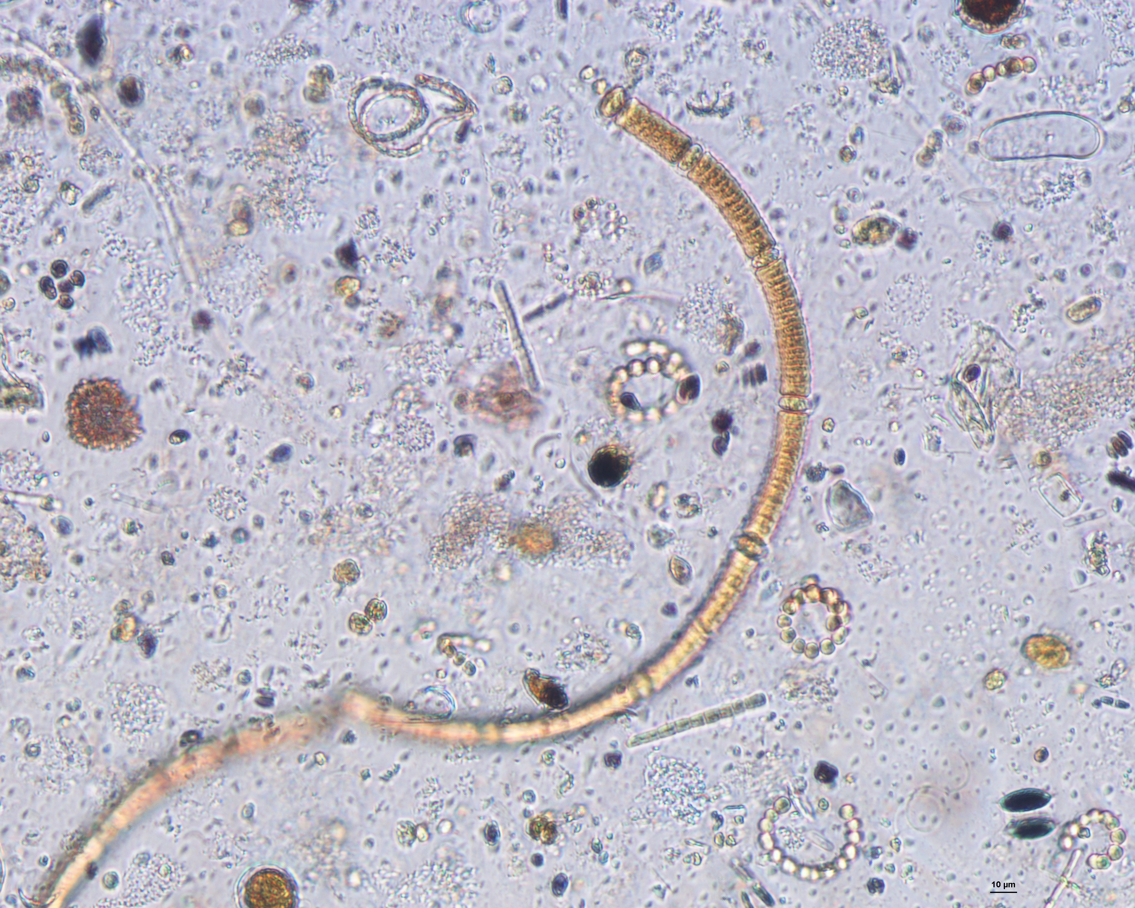 Dictyocha speculum